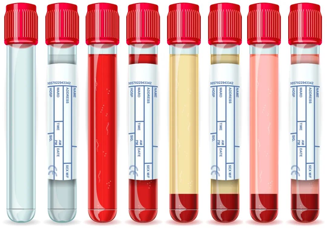 【ELISA Sample Processing Guide】Serum / Plasma